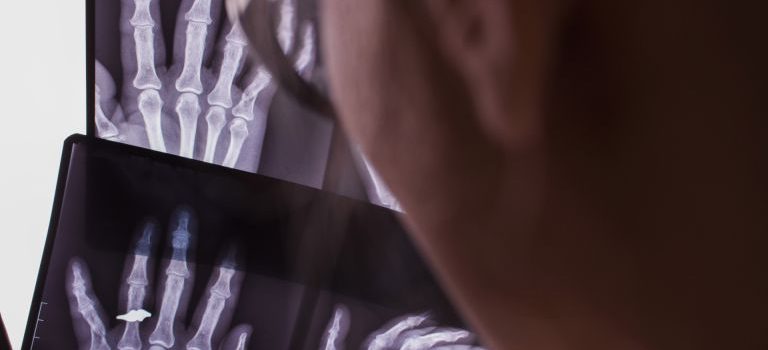 フランスの国民連帯と平等が支える公的ワクチン政策と医療制度の特徴と変遷 フランスの国民連帯と平等が支える公的ワクチン政策と医療制度の特徴と変遷